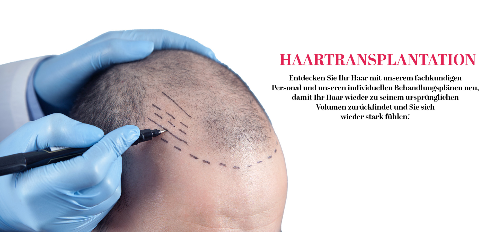 ayz slider Haartransplantation almanca